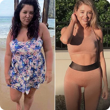 Bariatric Surgery in Turkey